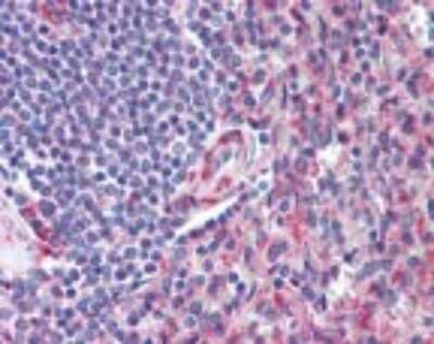 Immunohistochemistry-Paraffin: CD97 Antibody [NBP2-24552]