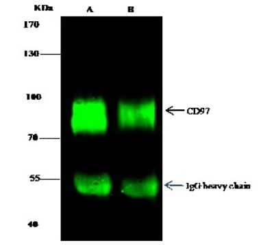 Immunoprecipitation: CD97 Antibody [NBP2-99764]