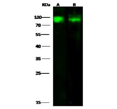 Western Blot: CD97 Antibody [NBP2-99764]