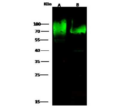 Western Blot: CD97 Antibody [NBP2-99765]