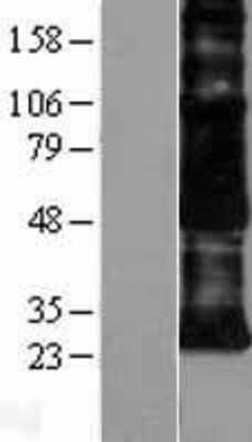 Western Blot: CD97 Overexpression Lysate [NBL1-08984]