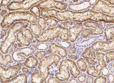 Immunohistochemistry-Paraffin: CD98 Antibody (071) [NBP2-90076]