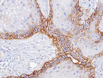 Immunohistochemistry-Paraffin: CD98 Antibody [NBP1-32148]