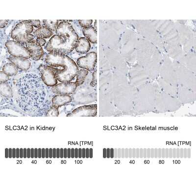 Immunohistochemistry-Paraffin: CD98 Antibody [NBP2-47515]