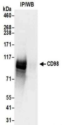 Immunoprecipitation: CD98 Antibody [NBP2-32221]