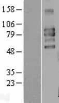 Western Blot: CD98 Overexpression Lysate [NBL1-16154]