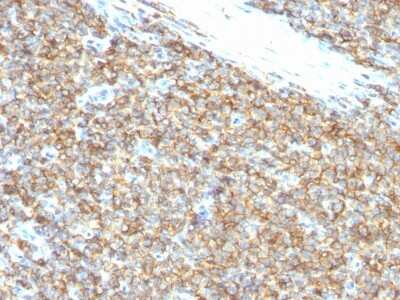 Immunohistochemistry-Paraffin: CD99 Antibody (12E7) [NBP2-44694]