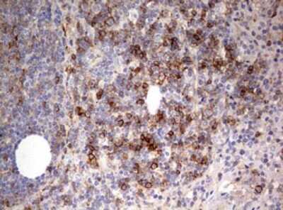 Immunohistochemistry-Paraffin: CD99 Antibody (OTI1D5) [NBP2-46181]