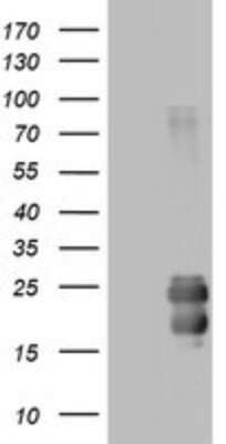 Western Blot: CD99 Antibody (OTI1D5) [NBP2-46181]