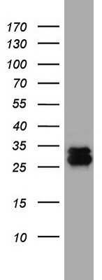 Western Blot: CD99 Antibody (OTI1D5) [NBP2-46181]