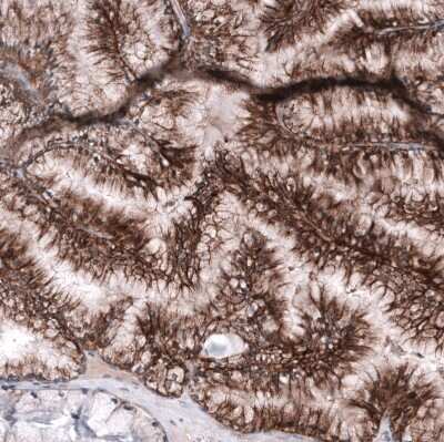 Immunohistochemistry-Paraffin: CD99 Antibody (CL12929) [NBP3-18550]