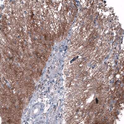Immunohistochemistry-Paraffin: CD99 Antibody (CL12929) [NBP3-18550]