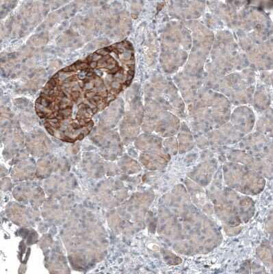 Immunohistochemistry-Paraffin: CD99 Antibody (CL12929) [NBP3-18550]