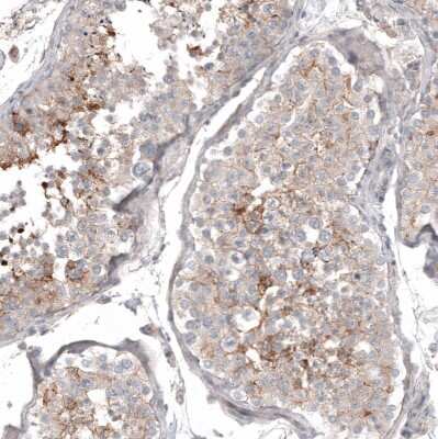 Immunohistochemistry-Paraffin: CD99 Antibody (CL12929) [NBP3-18550]