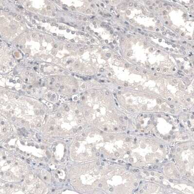 Immunohistochemistry-Paraffin: CD99 Antibody (CL12929) [NBP3-18550]