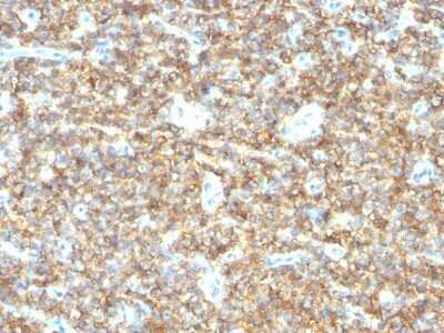 Immunohistochemistry-Paraffin: CD99 Antibody (HO36-1.1) - Azide and BSA Free [NBP2-47894]