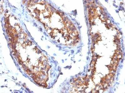 Immunohistochemistry-Paraffin: CD99 Antibody (HO36-1.1) [NBP2-44692]