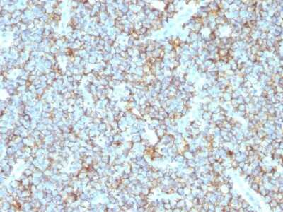 Immunohistochemistry-Paraffin: CD99 Antibody (MIC2/1495R) [NBP2-53368]