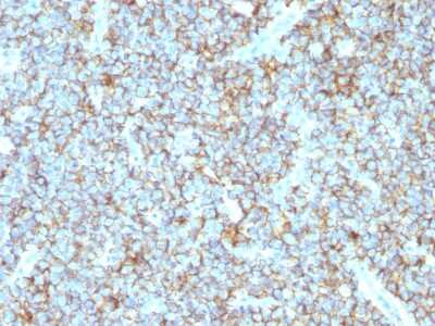 Immunohistochemistry-Paraffin: CD99 Antibody (MIC2/1495R) - Azide and BSA Free [NBP2-54373]