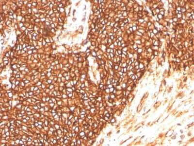 Immunohistochemistry-Paraffin: CD99 Antibody (MIC2/3478R) - Azide and BSA Free [NBP3-08589]