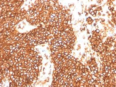 Immunohistochemistry-Paraffin: CD99 Antibody (MIC2/3478R) [NBP3-07315]