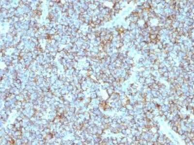 Immunohistochemistry-Paraffin: CD99 Antibody (MIC2/877) - Azide and BSA Free [NBP2-47895]