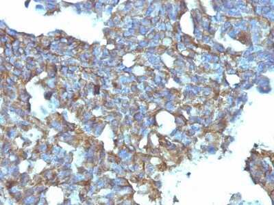 Immunohistochemistry-Paraffin: CD99 Antibody (MIC2/877) - IHC-Prediluted [NBP2-48034]