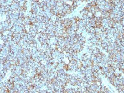 Immunohistochemistry-Paraffin: CD99 Antibody (MIC2/877) - IHC-Prediluted [NBP2-48034]