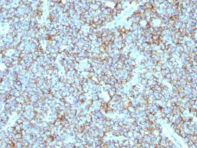 Immunohistochemistry-Paraffin: CD99 Antibody (MIC2/877) [NBP2-44695]