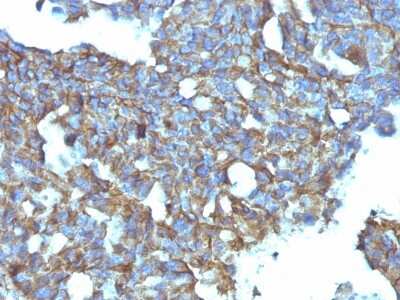 Immunohistochemistry-Paraffin: CD99 Antibody (MIC2/877) [NBP2-44695]
