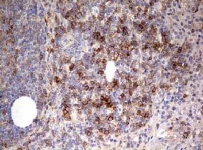 Immunohistochemistry: CD99 Antibody (OTI1D5) - Azide and BSA Free [NBP2-71197]