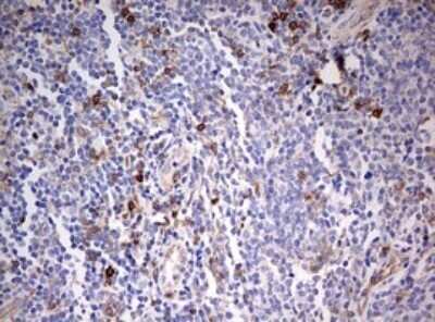 Immunohistochemistry: CD99 Antibody (OTI1D5) - Azide and BSA Free [NBP2-71197]