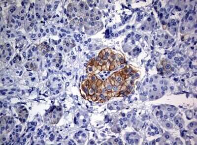 Immunohistochemistry: CD99 Antibody (OTI1D5) - Azide and BSA Free [NBP2-71197]