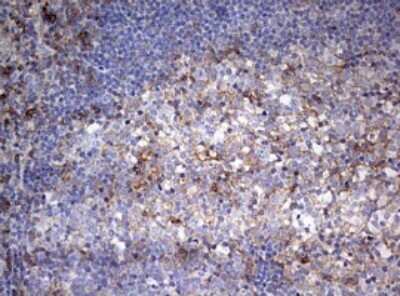 Immunohistochemistry: CD99 Antibody (OTI1D5) - Azide and BSA Free [NBP2-71197]