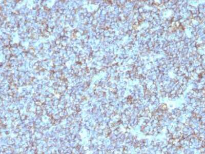 Immunohistochemistry-Paraffin: CD99 Antibody (SPM596) - IHC-Prediluted [NBP2-48035]