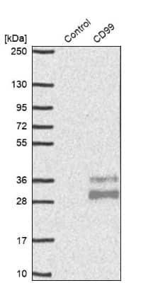 Western Blot: CD99 Antibody [NBP1-82650]