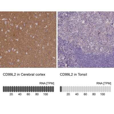 Immunohistochemistry-Paraffin: CD99-L2 Antibody [NBP1-85738]