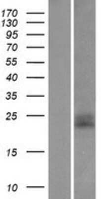 Western Blot: CD99 Overexpression Lysate [NBP2-04225]