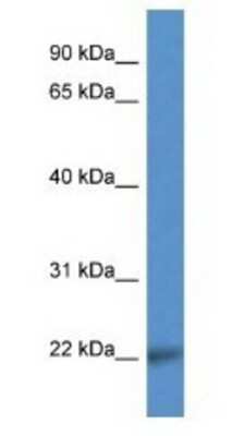 Western Blot: CD99-L2 Antibody [NBP1-79854]