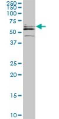 Western Blot: CDADC1 Antibody (1A2) [H00081602-M01]