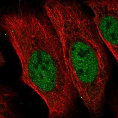 Immunocytochemistry/ Immunofluorescence: CDADC1 Antibody [NBP2-55703]