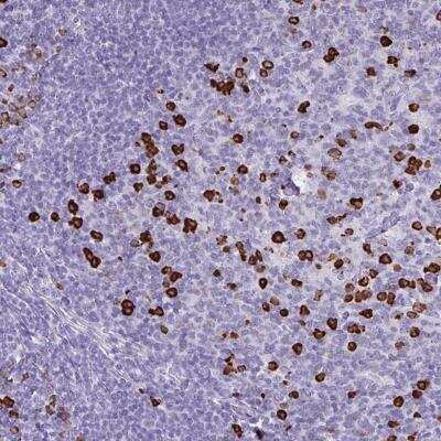 Immunohistochemistry-Paraffin: CDADC1 Antibody [NBP2-34108]