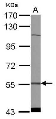 Western Blot: CDADC1 Antibody [NBP2-14906]