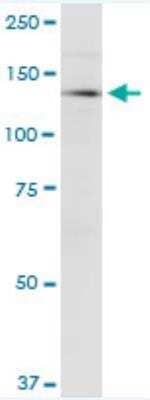 Western Blot: CDAN1 Antibody (7A10) [H00146059-M01-100ug]