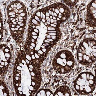 Immunohistochemistry-Paraffin: CDAN1 Antibody [NBP1-84574]