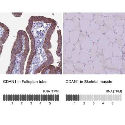 Immunohistochemistry-Paraffin: CDAN1 Antibody [NBP2-38473]