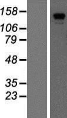 Western Blot: CDAN1 Overexpression Lysate [NBP2-05649]