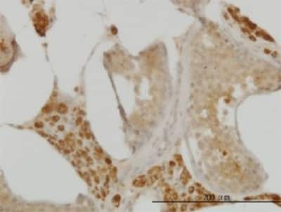 Immunohistochemistry-Paraffin: CDC123 Antibody (4B9) [H00008872-M08]