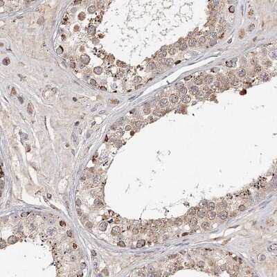 Immunohistochemistry-Paraffin: CDC123 Antibody [NBP1-88540]