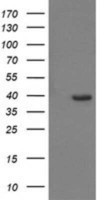 Western Blot: CDC123 Antibody (OTI1F8)Azide and BSA Free [NBP2-71391]